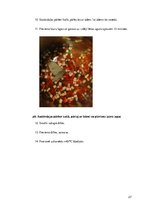 Prezentācija 'Ēdienkarte specializētajam uzturam', 27.