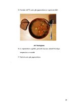 Prezentācija 'Ēdienkarte specializētajam uzturam', 28.