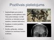 Prezentācija 'Mikročipu implanti smadzenēs un prāta kontrole', 7.