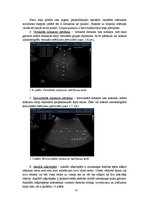 Diplomdarbs 'Ultraskaņas iekārtas zonžu nolietojuma novērtēšanas metodes', 12.