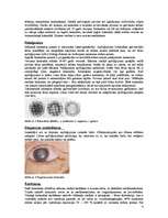 Referāts 'Redzes funkciju īpatnības dažādu acs pataloģiju gadījumos ', 4.