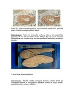 Konspekts 'Kļūdu labojums patoloģijā', 7.