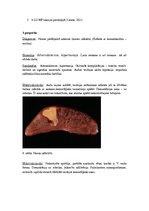 Konspekts 'Kļūdu labojums patoloģijā', 9.