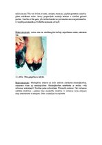 Konspekts 'Kļūdu labojums patoloģijā', 12.