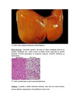 Konspekts 'Kļūdu labojums patoloģijā', 15.