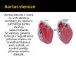 Prezentācija 'Aortas stenoze', 2.