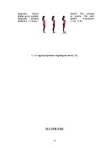 Referāts 'Muguras jostas daļas sāpēs, ārstēšana un profilakse', 17.