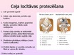 Prezentācija 'Metāliskie biomateriāli locītavu protezēšanā', 16.