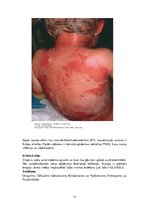 Konspekts 'Patogēnie koki', 17.