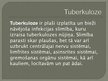 Prezentācija 'Trīs baktēriju izraisītas saslimšanas', 6.