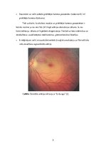 Konspekts 'Centrālās artērijas oklūzija', 5.