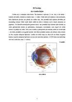 Referāts 'Acs uzbūve', 7.