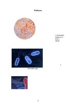 Referāts 'Salmoneloze', 13.