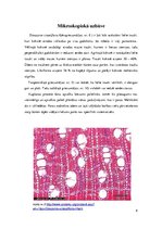 Referāts 'Melnkoks', 8.