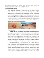 Referāts 'Saslimstība ar ļaundabīgajiem audzējiem', 8.