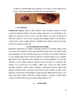 Referāts 'Saslimstība ar ļaundabīgajiem audzējiem', 9.