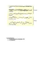 Konspekts 'Miegs', 4.