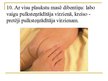 Prezentācija 'Zīdaiņu masāža', 15.