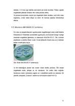 Referāts 'Magnētterapija', 55.