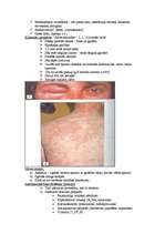 Konspekts 'Mikrobioloģija. Alerģijas', 5.