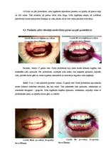 Referāts 'Zobu higiēnista loma mutes dobuma veselības saglabāšanā', 26.