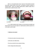 Referāts 'Zobu higiēnista loma mutes dobuma veselības saglabāšanā', 27.