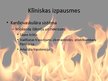 Prezentācija 'Tvana gāze', 8.