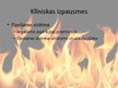 Prezentācija 'Tvana gāze', 9.