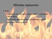Prezentācija 'Tvana gāze', 11.