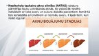 Prezentācija 'Nealkohola taukainā aknu slimība (steatoze)', 2.