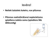 Prezentācija 'Intraosālā pieeja', 20.