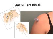 Prezentācija 'Intraosālā pieeja', 26.