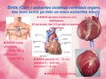 Prezentācija 'Sirds uzbūve', 2.