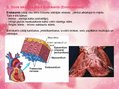 Prezentācija 'Sirds uzbūve', 8.