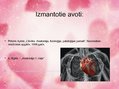 Prezentācija 'Sirds uzbūve', 12.