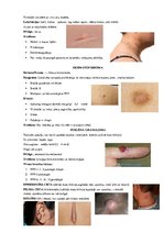 Konspekts 'Ādas audzēji', 2.