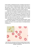 Referāts 'Hemolītiskās anēmijas', 12.