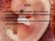 Prezentācija 'Ektopiska grūtniecība. Vaskulārā endotēlija augšanas faktors', 14.