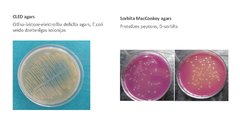 Prezentācija 'Escherichia coli mikrobioloģiskās diagnostikas principi', 11.