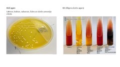 Prezentācija 'Escherichia coli mikrobioloģiskās diagnostikas principi', 12.