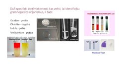Prezentācija 'Escherichia coli mikrobioloģiskās diagnostikas principi', 13.
