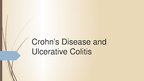 Prezentācija 'Crohn's Disease', 1.