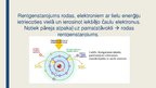 Prezentācija 'Fizikas loma slimību diagnostikā un terapijā', 3.