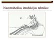 Prezentācija 'Intubācija', 11.
