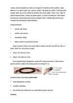 Referāts 'Interneta pieslēgumi', 14.