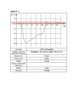 Paraugs 'Impulsveida signālu parametri', 5.