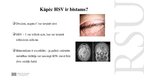 Prezentācija 'Kāpēc zobu higiēnistiem nekad nevajadzētu ārstēt pacientu ar aktīvu orālo herpes', 11.