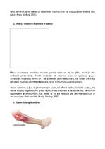 Prezentācija 'Biežākās traumas fitnesā', 2.