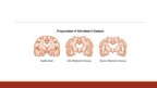 Prezentācija 'Alzheimer Disease', 3.