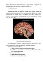 Referāts 'Cilvēka smadzeņu pusložu lateralizācija', 6.